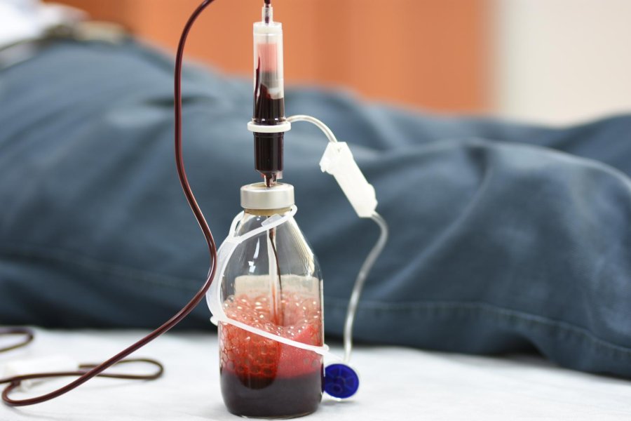 Ozone Therapy